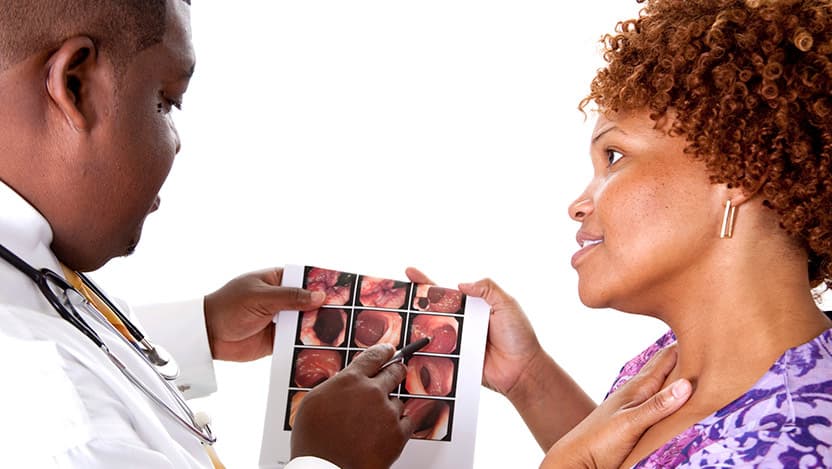 Which colon cancer screening is right for you?