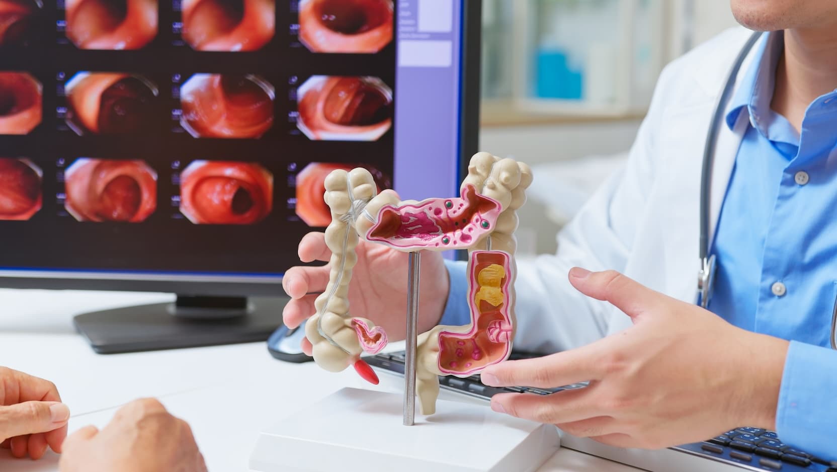 doctor showing patient model of colon