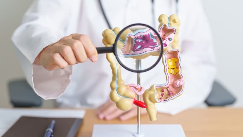 doctor holding magnifying glass up to GI tract model