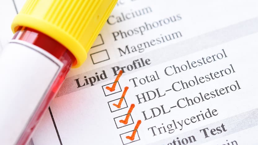 Lipid testing