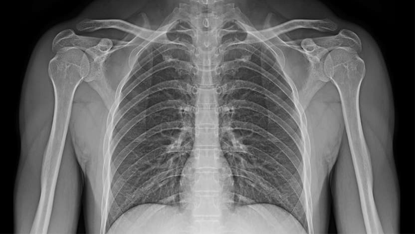 Image of X-ray