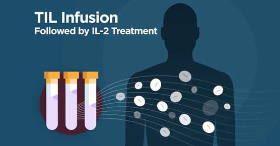 TIL therapy