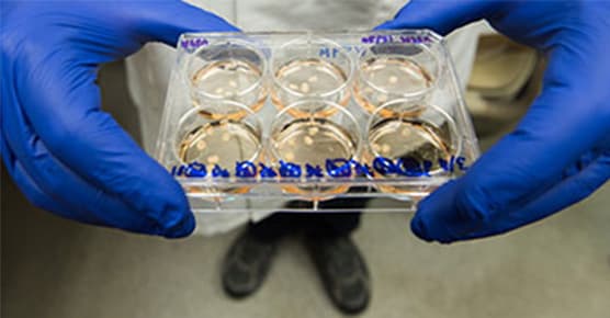 Image of research being done on diabetes